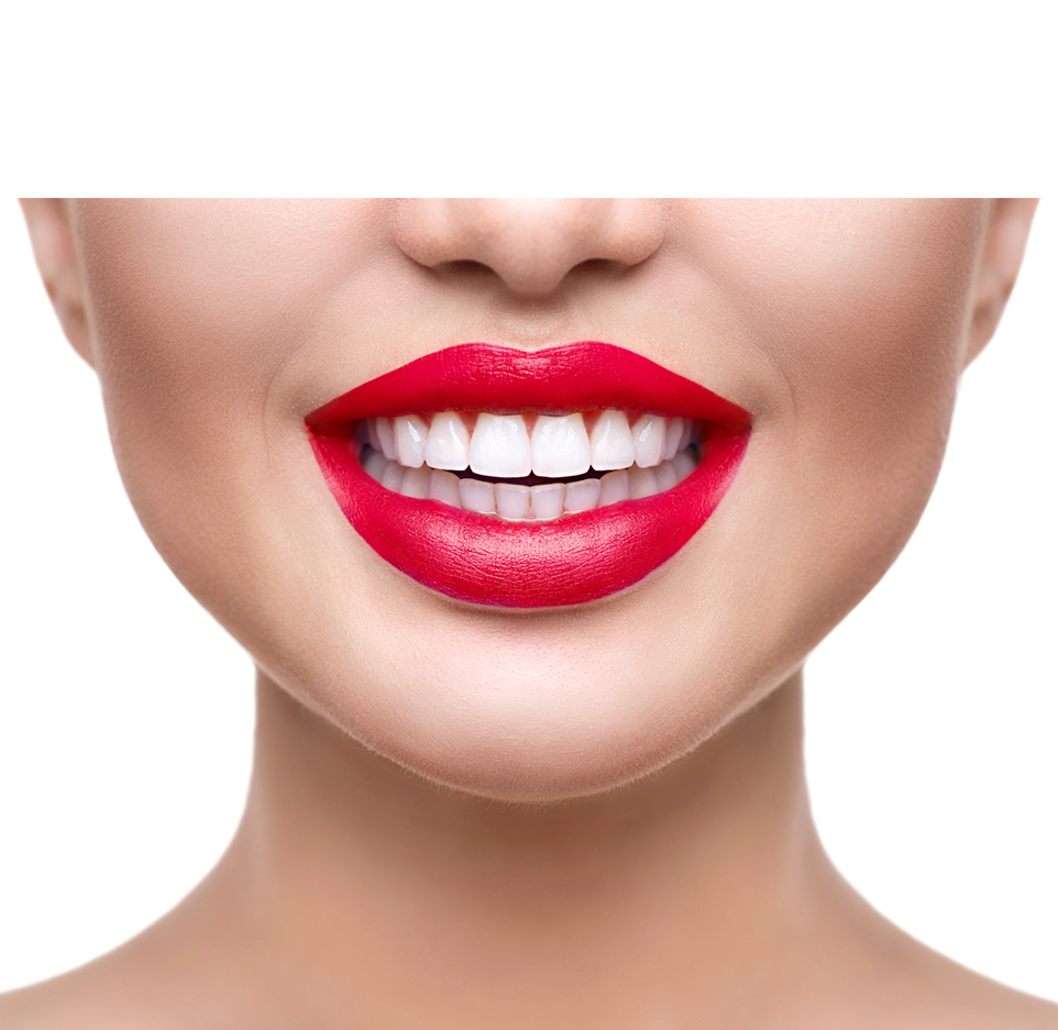 Porcelain Veneers